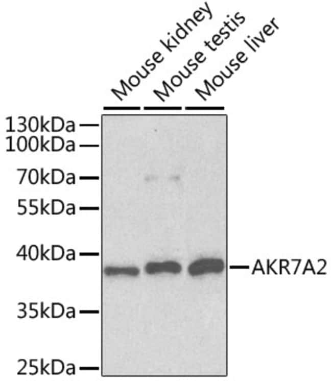 100UL AKR7A2 ANTIBODY 100 UL