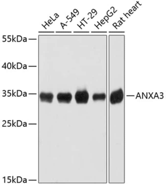100UL ANNEXIN A3 ANTIBODY 100 UL