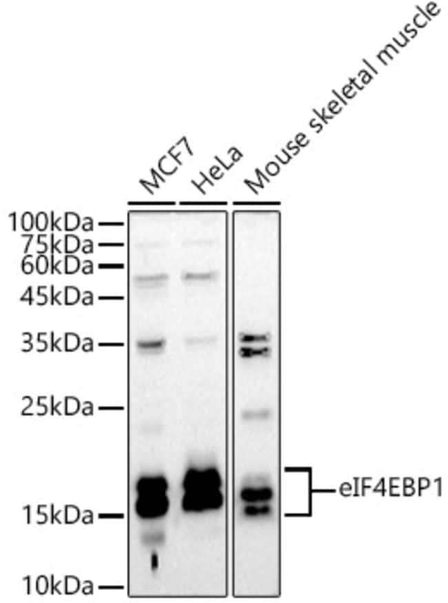 100UL 4EBP1 ANTIBODY 100 UL