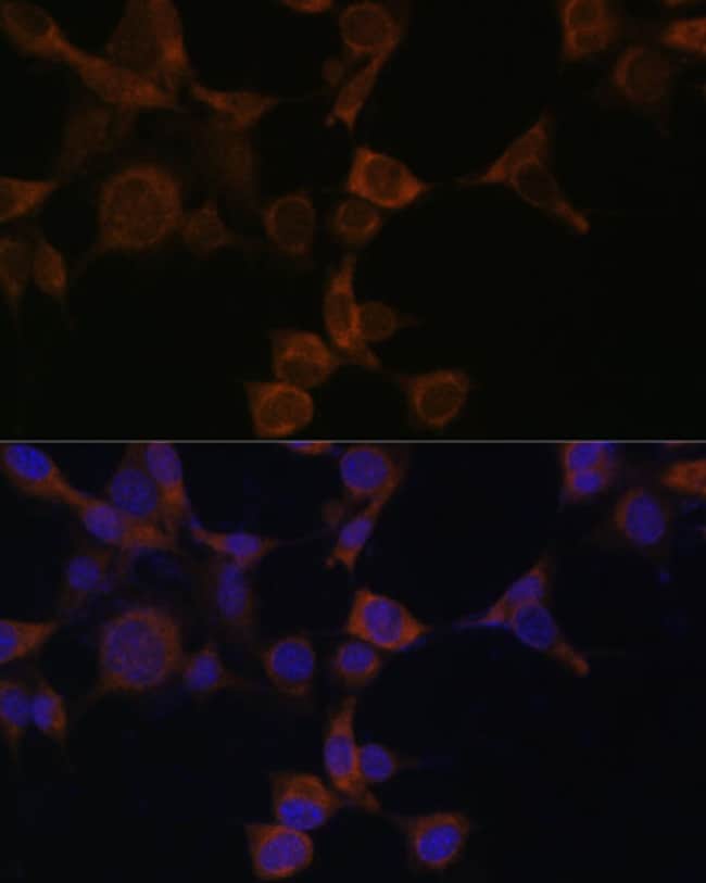 100UL AMPK BETA-1 ANTIBODY 100 UL