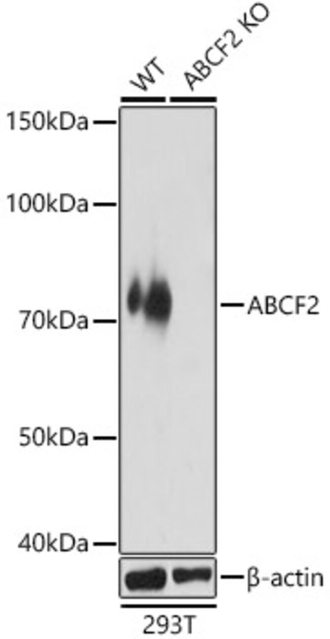 100UL ABCF2 ANTIBODY 100 UL