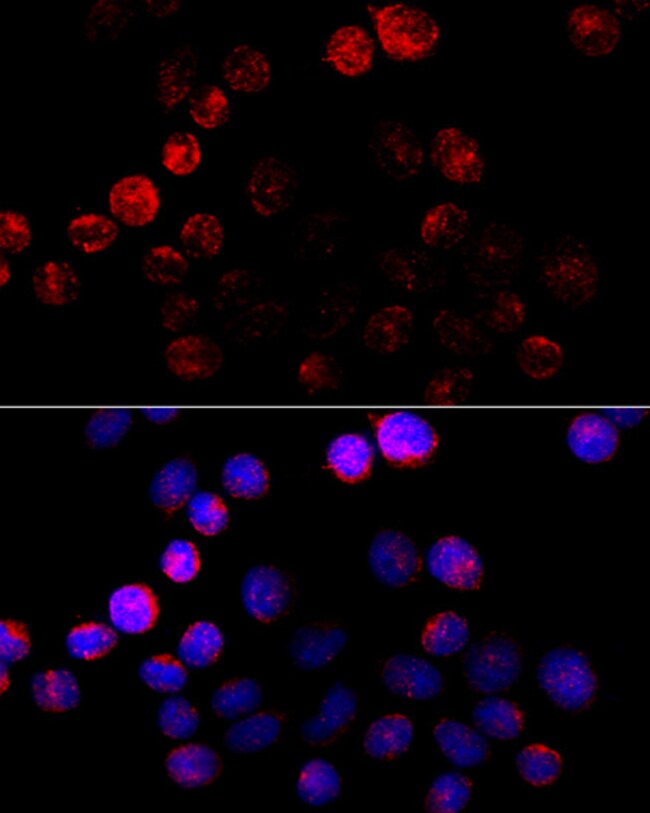 100UL AROMATASE ANTIBODY 100 UL
