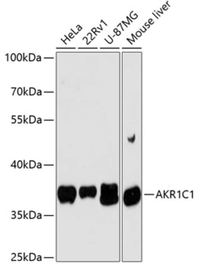 100UL AKR1C1 ANTIBODY 100 UL