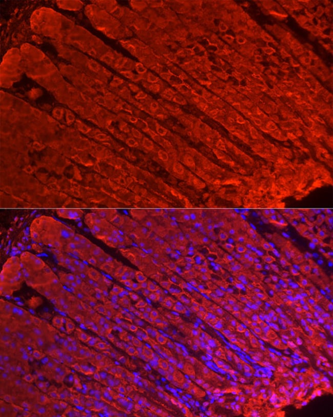 100UL ALDH3A1 ANTIBODY 100 UL