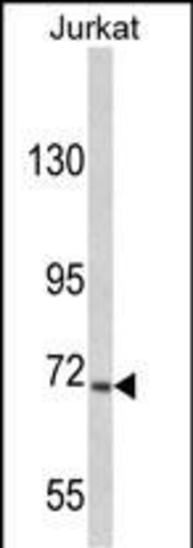 ANTI-USP19, 0,1 MG