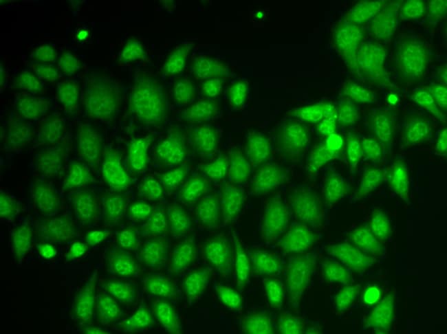 100UL AKR1A1 ANTIBODY 100 UL