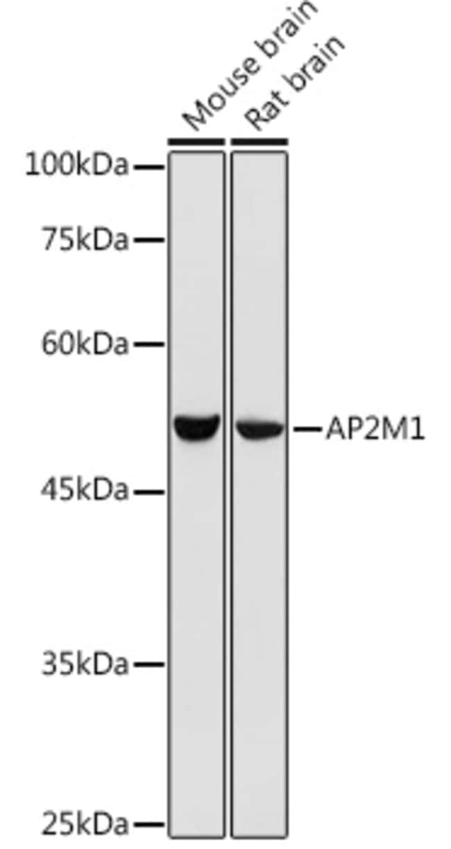 100UL AP2M1 ANTIBODY 100 UL