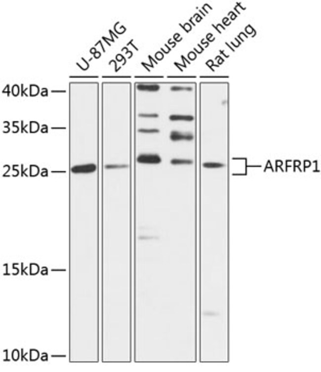 100UL ARFRP1 ANTIBODY 100 UL