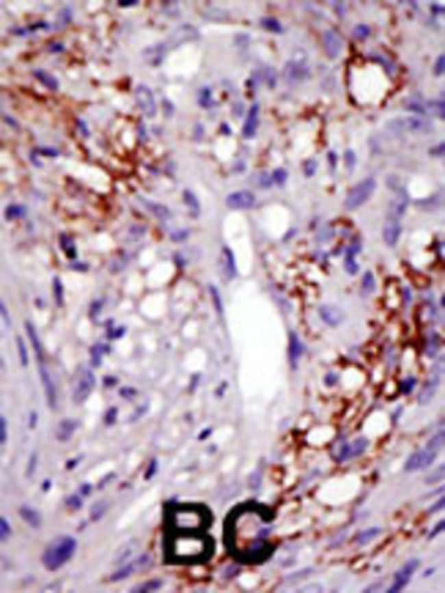 ANTI-USP22, 0,1mg .