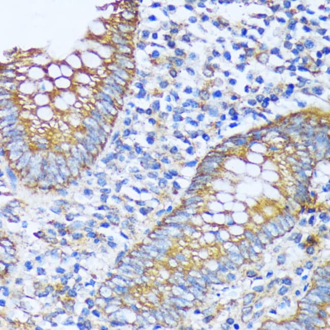 100UL ACOT2 ANTIBODY 100 UL