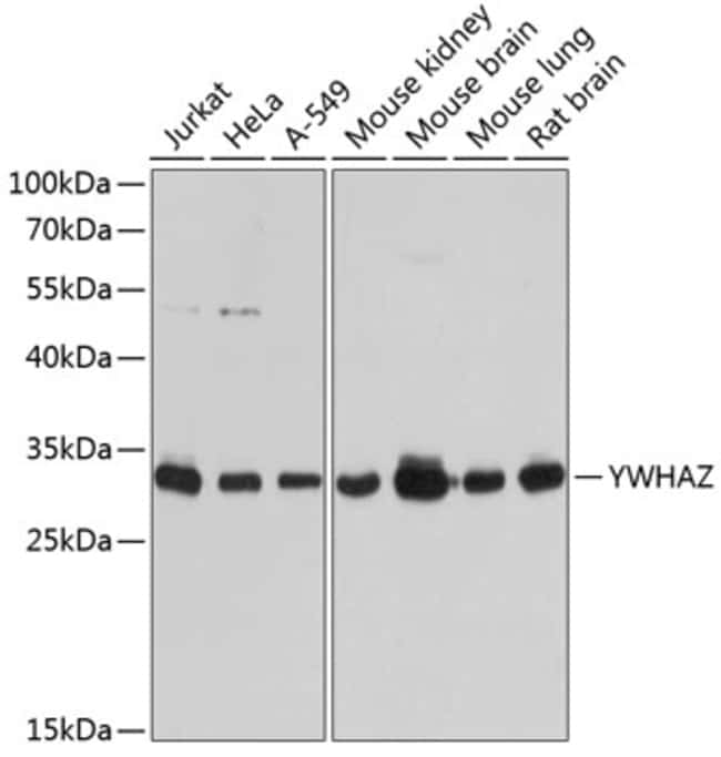 100UL 14-3-3 ZETA ANTIBODY 100 UL