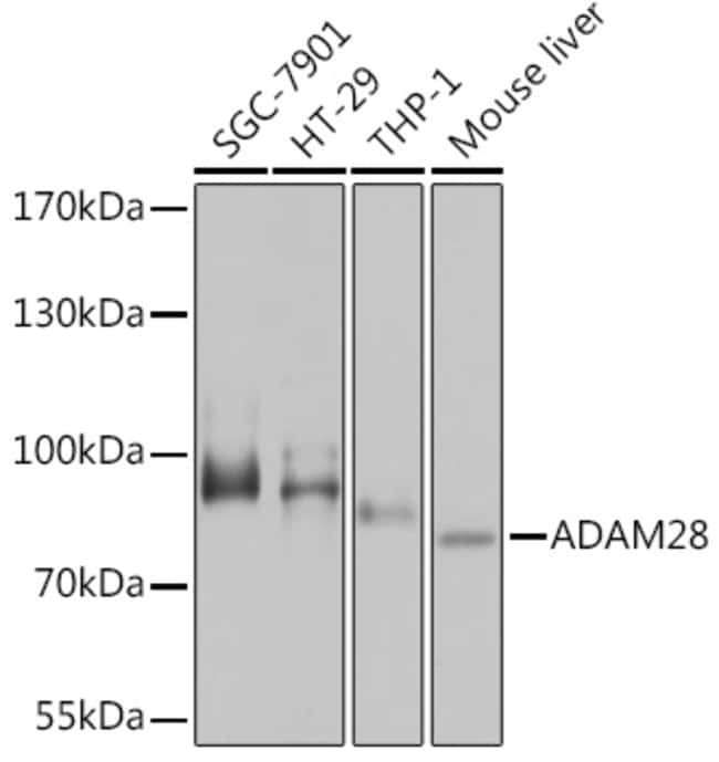 100UL ADAM28 ANTIBODY 100 UL