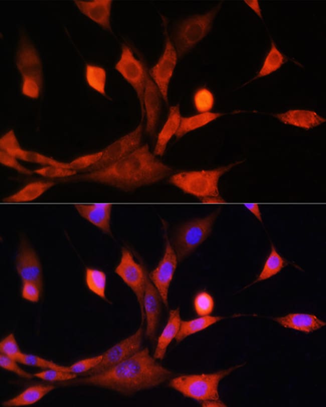 100UL ADK ANTIBODY 100 UL