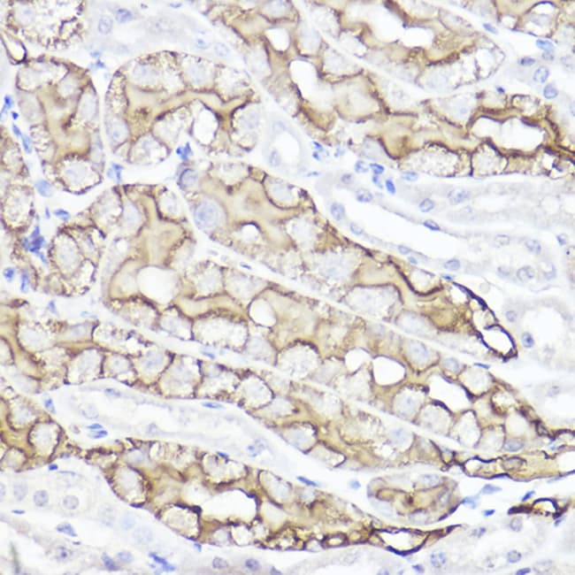 100UL AQUAPORIN 1 ANTIBODY 100 UL