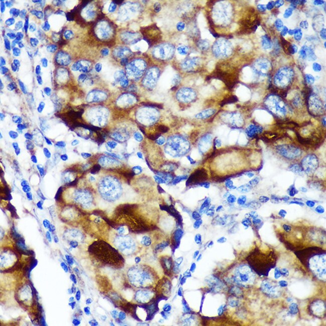 100UL ABCF3 ANTIBODY 100 UL