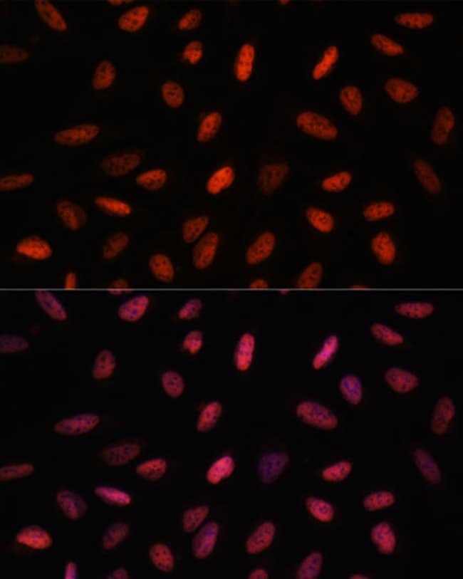 100UL ARID1B ANTIBODY 100 UL