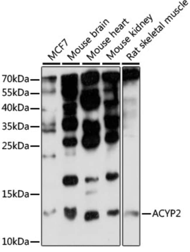 100UL ACYP2 ANTIBODY 100 UL