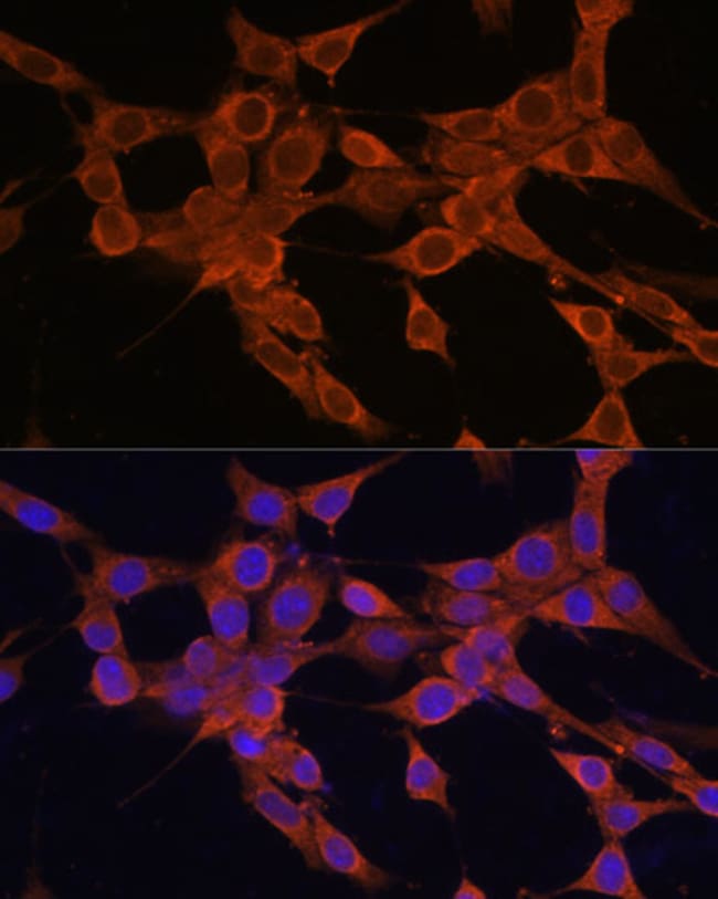 100UL BAX ANTIBODY 100 UL