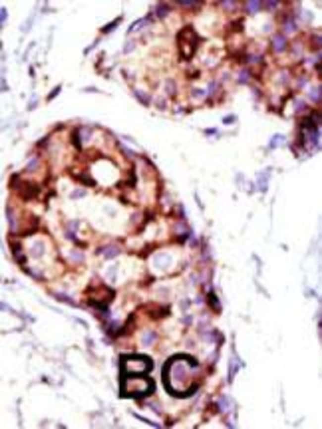 ANTI-TSG101, 0,1 MG
