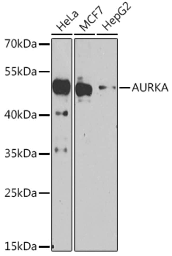 100UL AURORA A ANTIBODY 100 UL