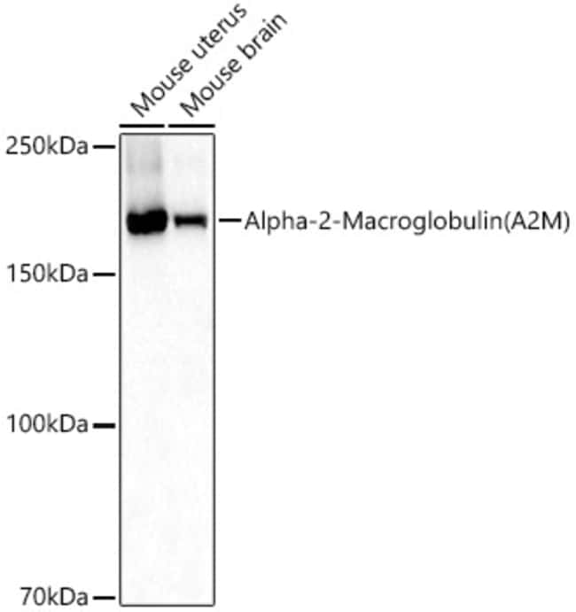 100UL A2M ANTIBODY 100 UL