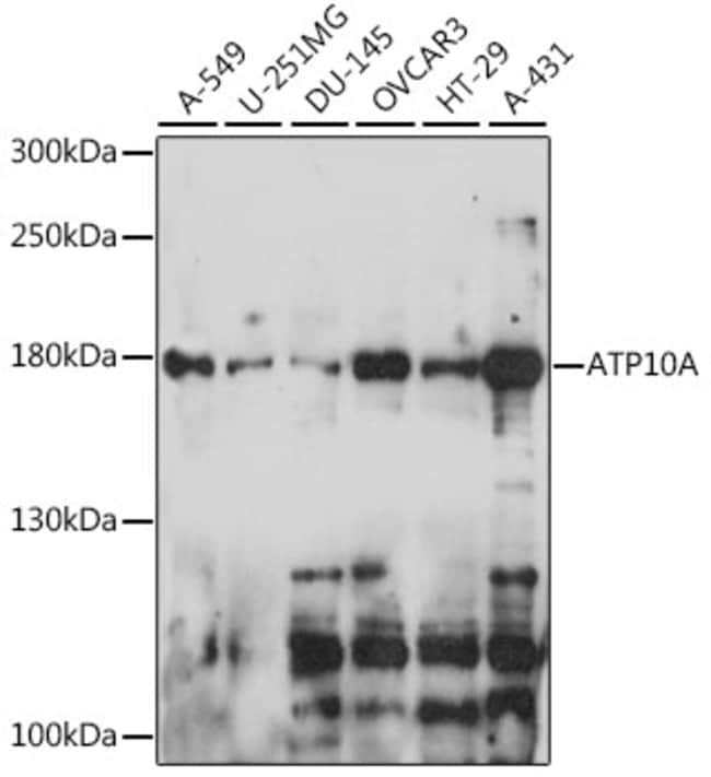 100UL ATP10A ANTIBODY 100 UL