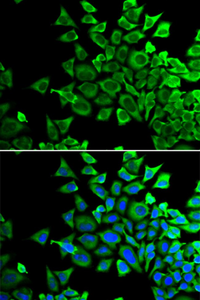 100UL BAD ANTIBODY 100 UL