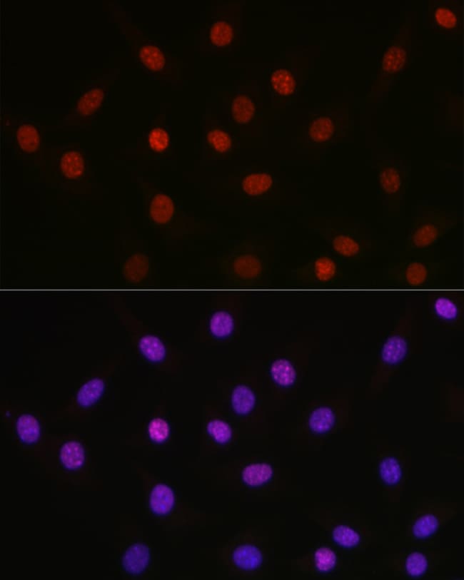 100UL ACETYL-HMGB1 (LYS29) ANTIBODY 100
