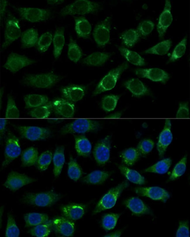 100UL ALDH3A2 ANTIBODY 100 UL