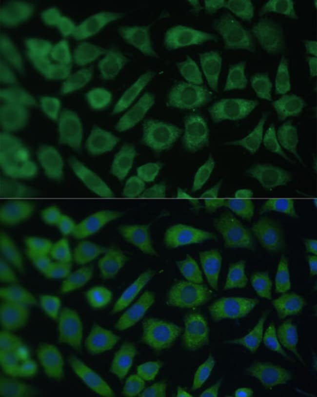 100UL ARL3 ANTIBODY 100 UL