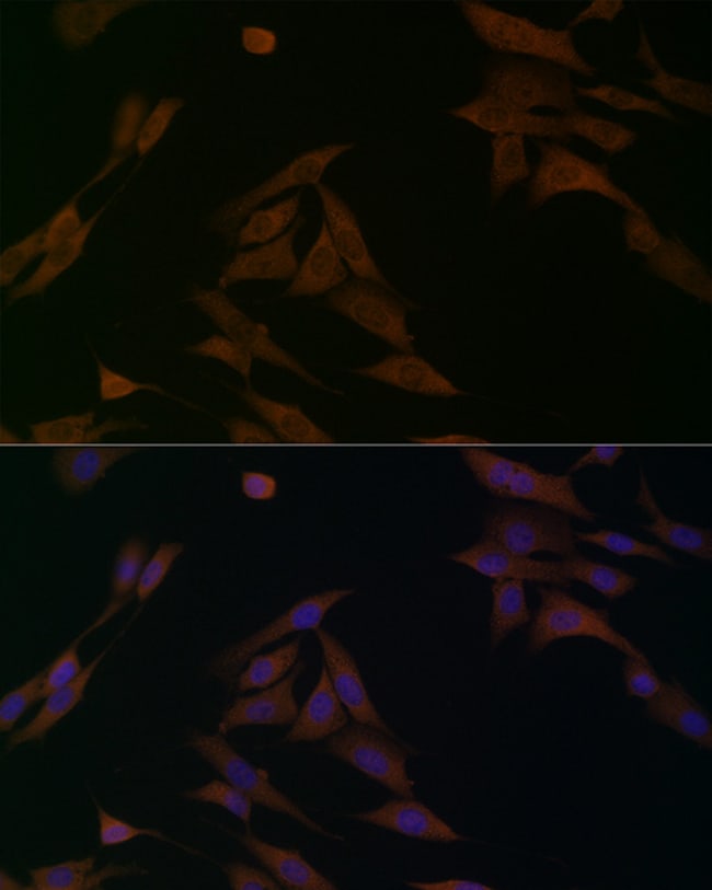 100UL BCAT1 ANTIBODY 100 UL