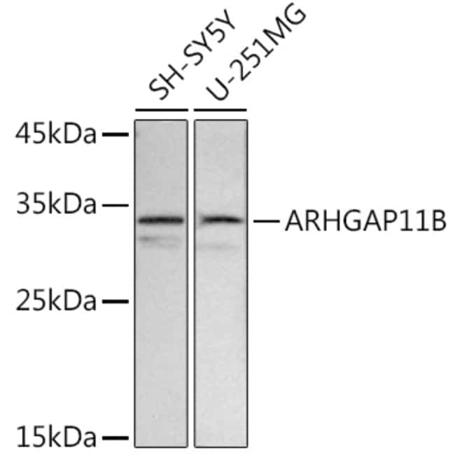 100UL ARHGAP11B ANTIBODY 100 UL