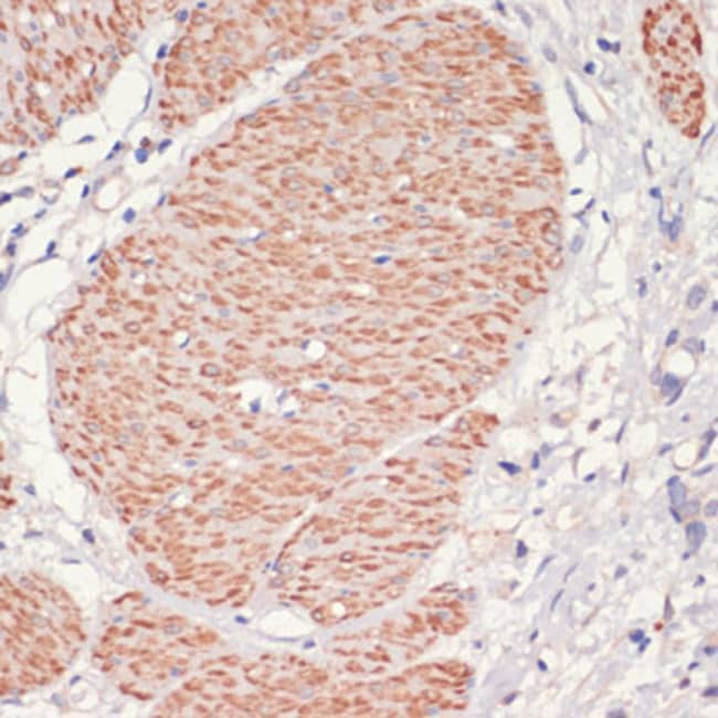 100UL AMPK ALPHA-1 ANTIBODY 100 UL