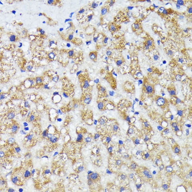 100UL AMOTL2 ANTIBODY 100 UL