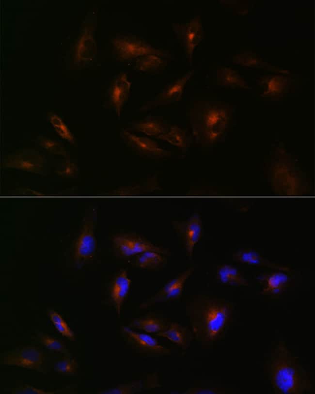 100UL ABCA2 ANTIBODY 100 UL