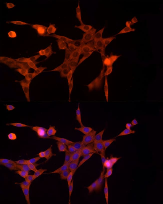 100UL AKR1B1 ANTIBODY 100 UL