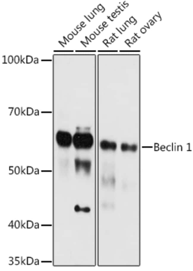 100UL BECLIN 1 ANTIBODY 100 UL