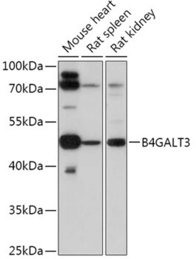 100UL B4GALT3 ANTIBODY 100 UL