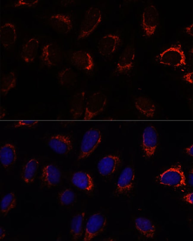 100UL AP3S2 ANTIBODY 100 UL