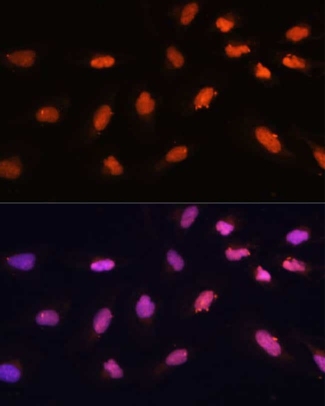 100UL BAZ2A ANTIBODY 100 UL