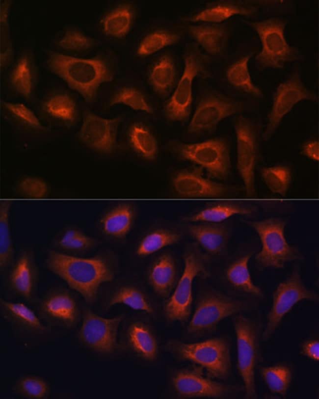 100UL ARFGAP2 ANTIBODY 100 UL