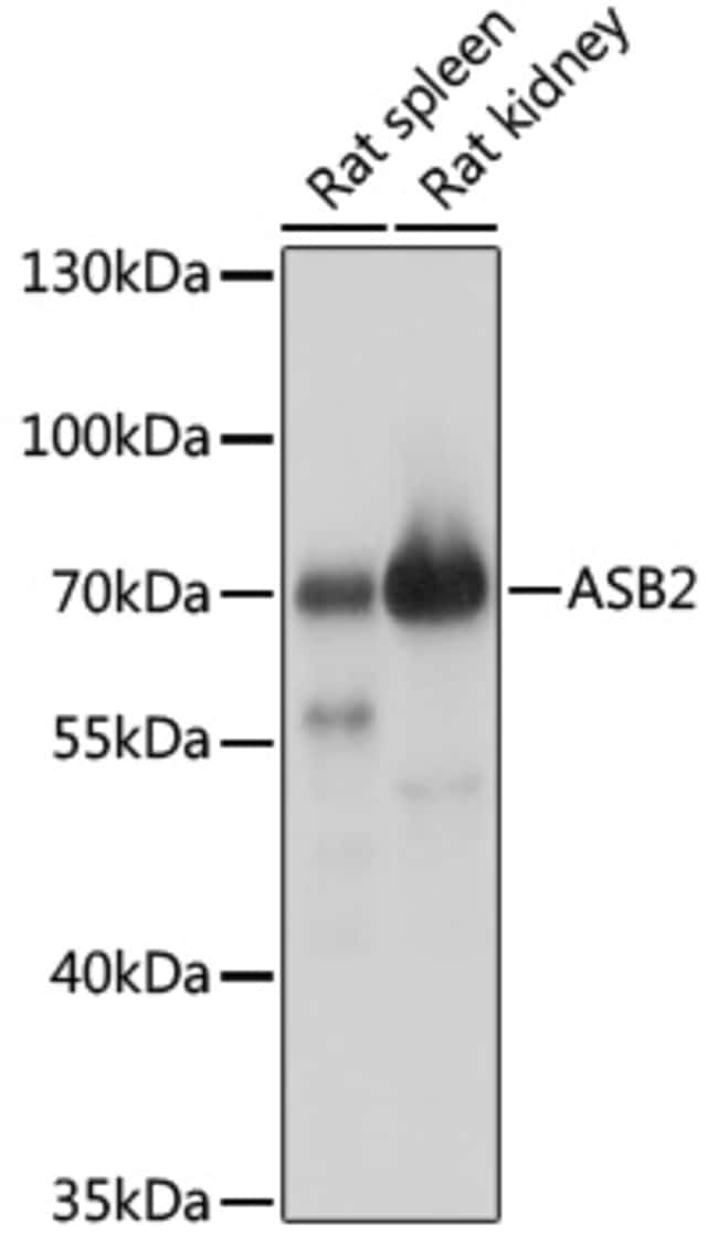 100UL ASB2 ANTIBODY 100 UL