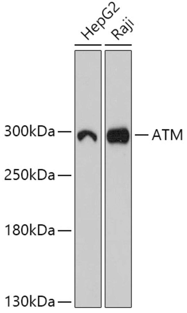 100UL ATM ANTIBODY 100 UL