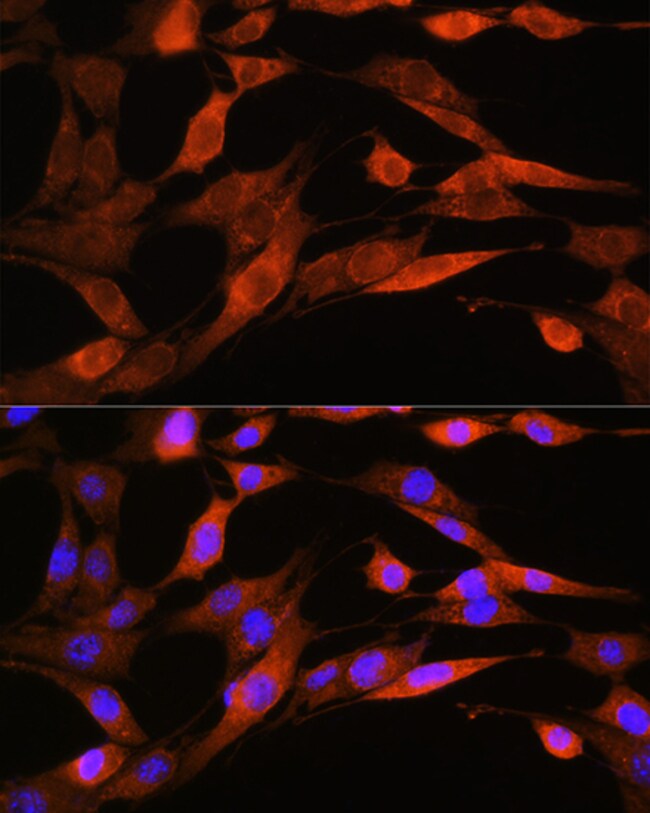 100UL ASS1 ANTIBODY 100 UL