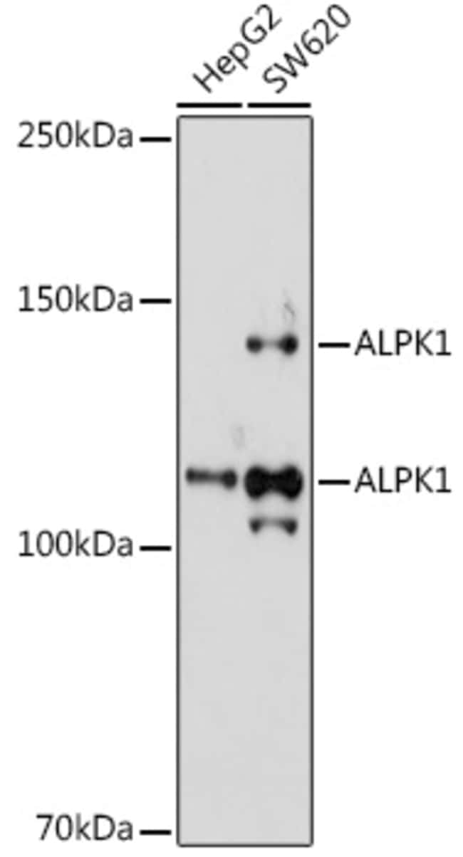 100UL ALPK1 ANTIBODY 100 UL