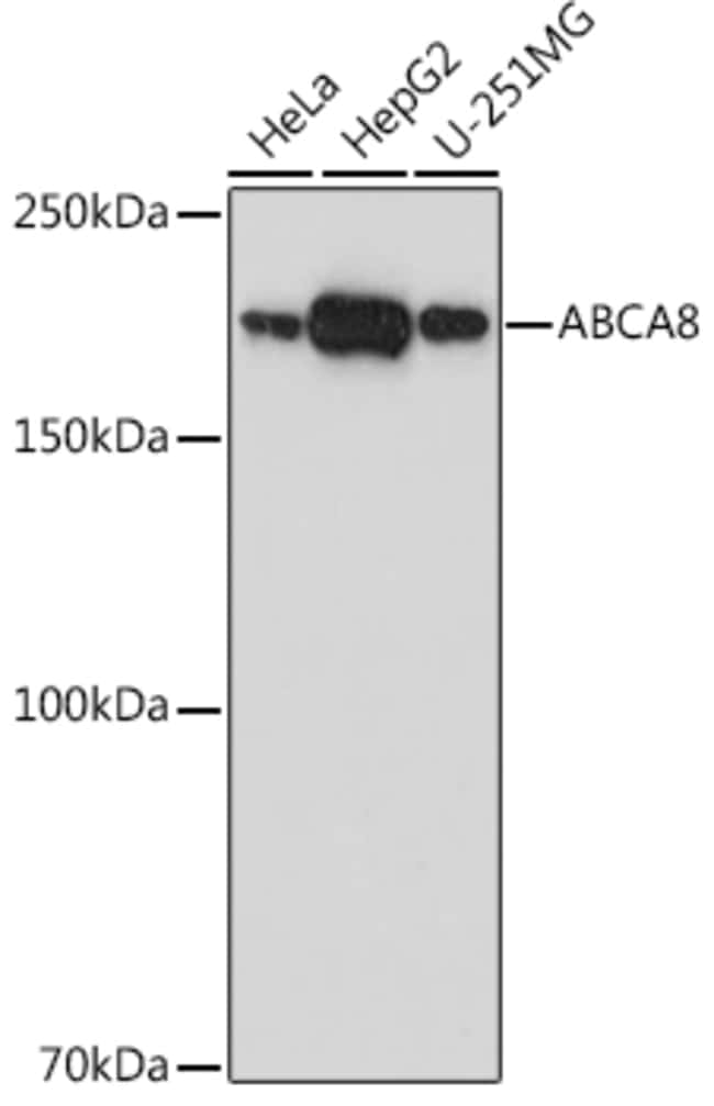 100UL ABCA8 ANTIBODY 100 UL