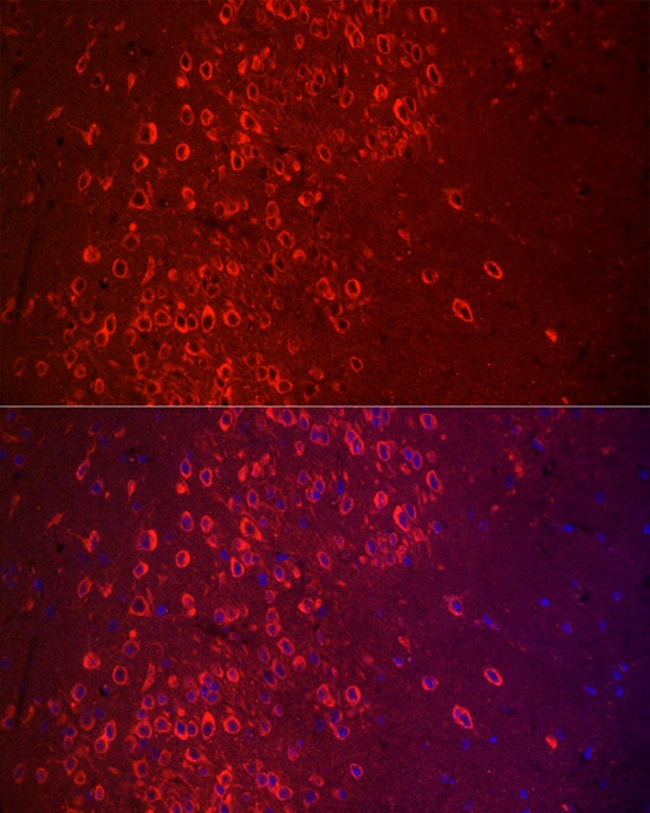 100UL APLP1 ANTIBODY 100 UL