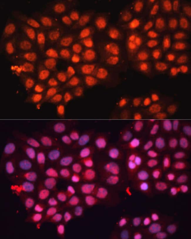 100UL ABCB8 ANTIBODY 100 UL