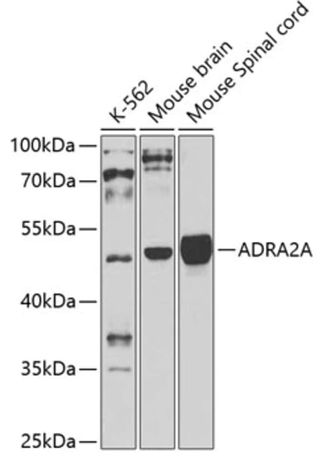 100UL ALPHA-2A ADRENERGIC RECEPTOR A 100