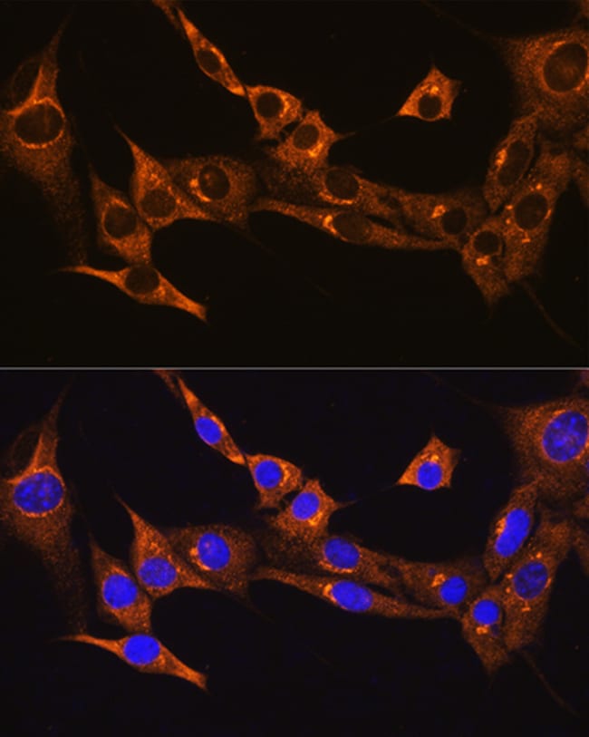 100UL BDKRB2 ANTIBODY 100 UL